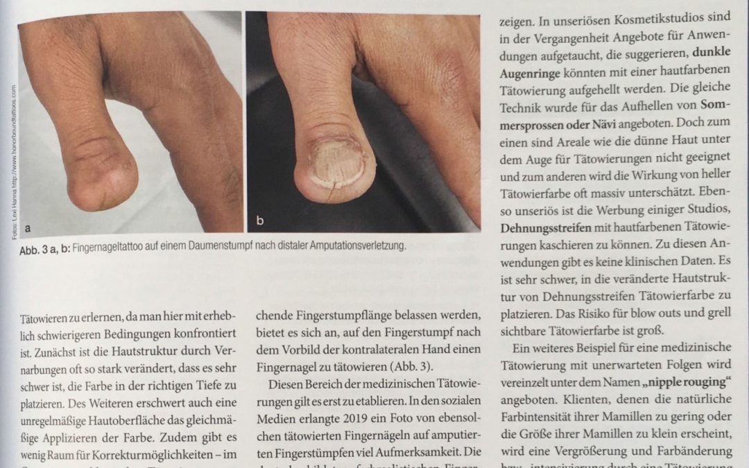 Zeitschrift-Haut-Heft-2,-April-2020-Seite-64-66-5